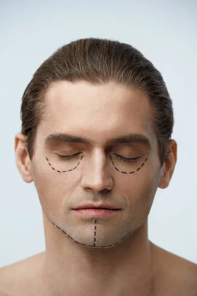 Cirugía plástica. Retrato de hombre guapo con líneas en la cara — Foto de Stock