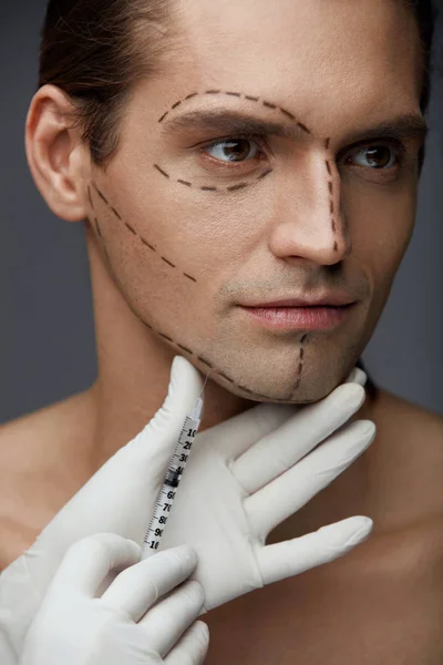 Plastická chirurgie. Pohledný muž s tváří linky dostává injekce — Stock fotografie