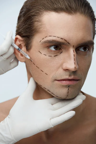 Plastische Chirurgie. schöner Mann mit Gesichtszügen bekommt Spritzen — Stockfoto