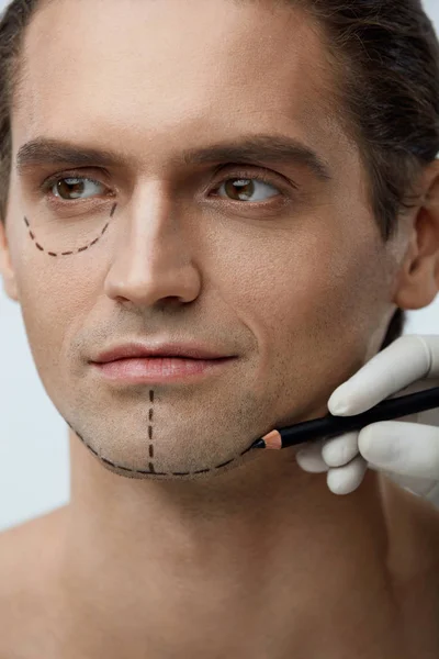 Bello uomo con linee nere sul viso prima di chirurgia plastica — Foto Stock