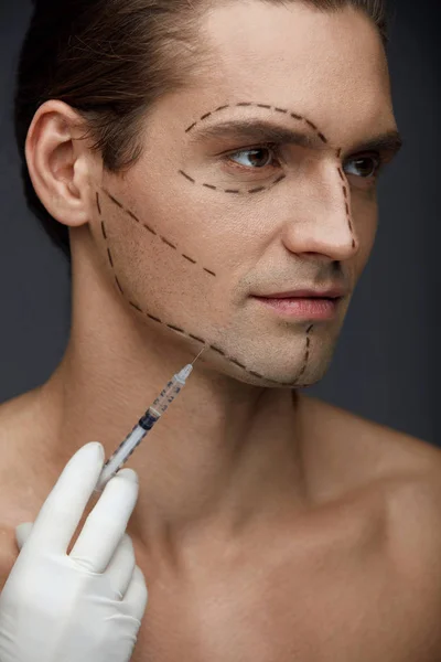 Plastische Chirurgie. schöner Mann mit Gesichtszügen bekommt Spritzen — Stockfoto