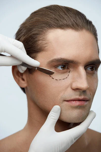 Chirurgia plastyczna. Przystojny mężczyzna twarz z czarnymi liniami pod okiem — Zdjęcie stockowe
