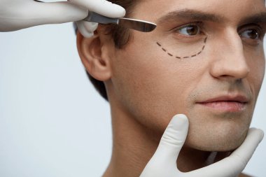 Plastic Surgery. Handsome Male Face With Black Lines Under Eye clipart