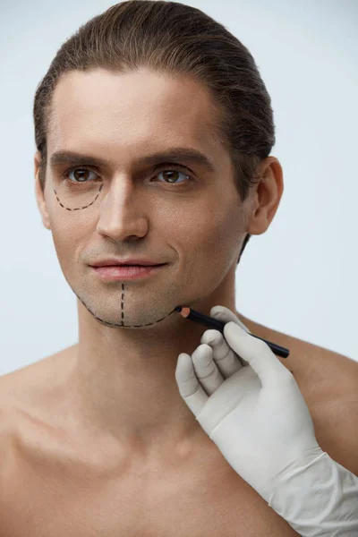 Operace obličeje krása. Pohledný muž s linkami na obličej — Stock fotografie