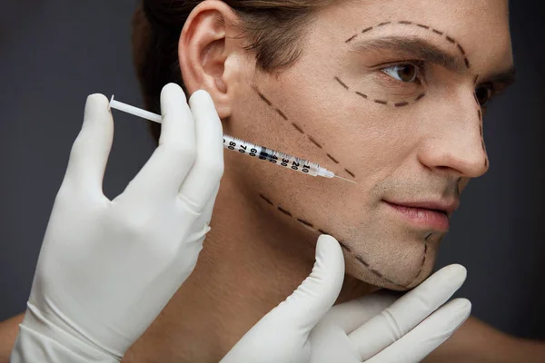 Plastická chirurgie. Pohledný muž s tváří linky dostává injekce — Stock fotografie