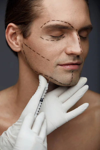 Beau mâle avec visage lignes obtention visage beauté injections — Photo