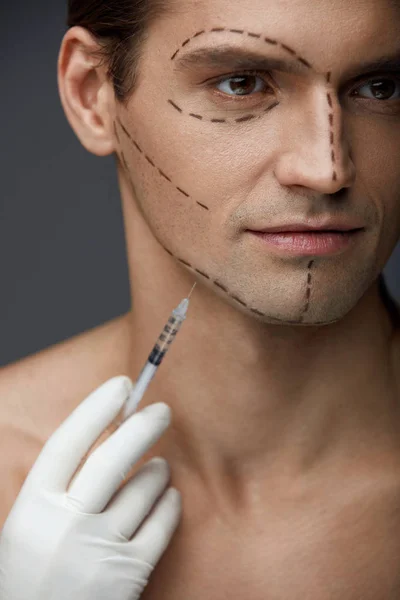 Cirurgia Plástica. Homem bonito com linhas de rosto recebendo injeções — Fotografia de Stock