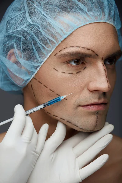 Mężczyzna chirurgii plastycznej. Człowiek z liniami twarzy coraz zastrzyki — Zdjęcie stockowe