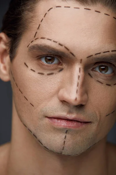 Plastická chirurgie. Pohledný muž s linkami na kůži obličeje — Stock fotografie