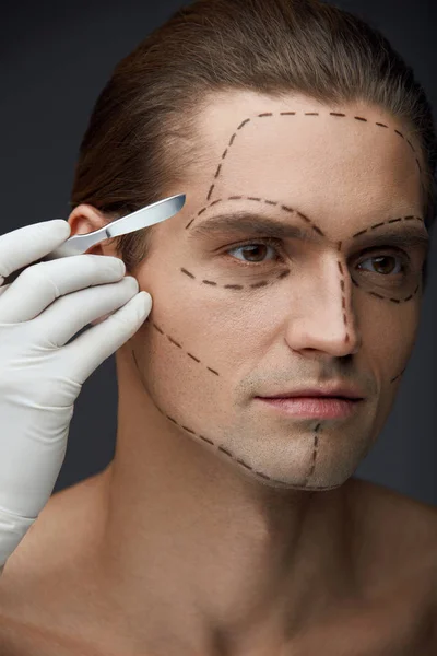 Человек с черными линиями на лице перед операцией пластической хирургии — стоковое фото
