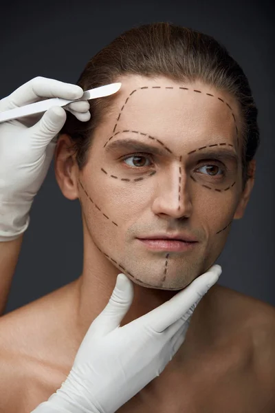 Muž s černými čarami na tvář před operací plastické chirurgie — Stock fotografie
