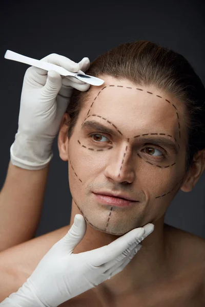 Człowiek z czarnymi liniami na twarz przed operację plastyczną — Zdjęcie stockowe