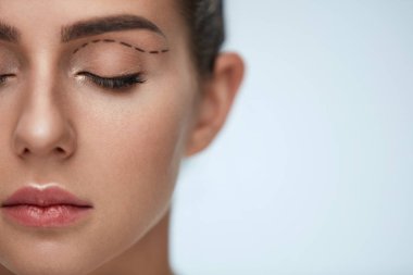 Plastik cerrahi işlem. Kadın yüzü siyah cerrahi çizgiler ile
