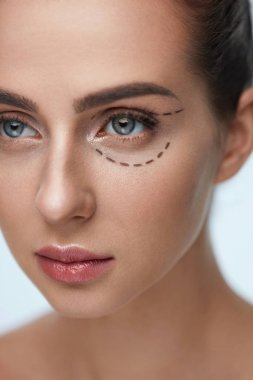 Plastik cerrahi işlem. Kadın yüzü siyah cerrahi çizgiler ile