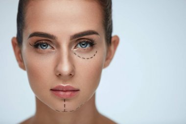 Plastic Surgery Operation. Woman Face With Black Surgical Lines clipart