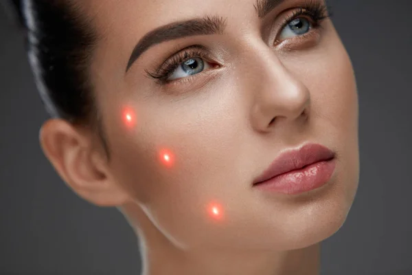 Closeup Of Beautiful Woman Face With Laser Points On Facial Skin — Stock Photo, Image