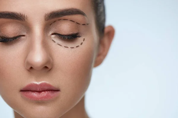 Operazione di chirurgia plastica. Donna faccia con linee chirurgiche nere — Foto Stock