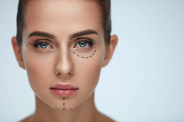 Operazione di chirurgia plastica. Donna faccia con linee chirurgiche nere — Foto Stock