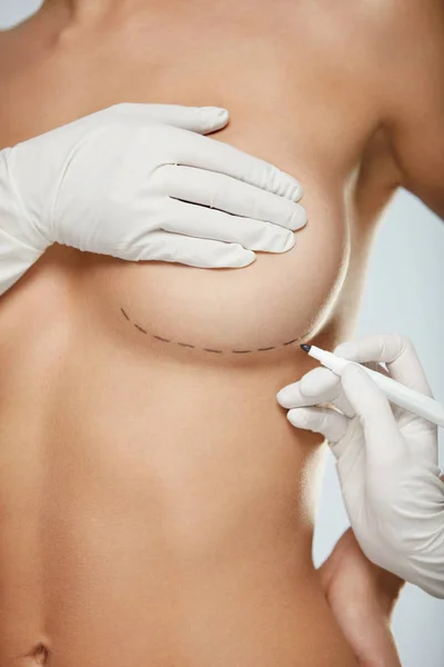 Chirurgia plastica del corpo. Mani che disegnano linee sul seno della donna . — Foto Stock