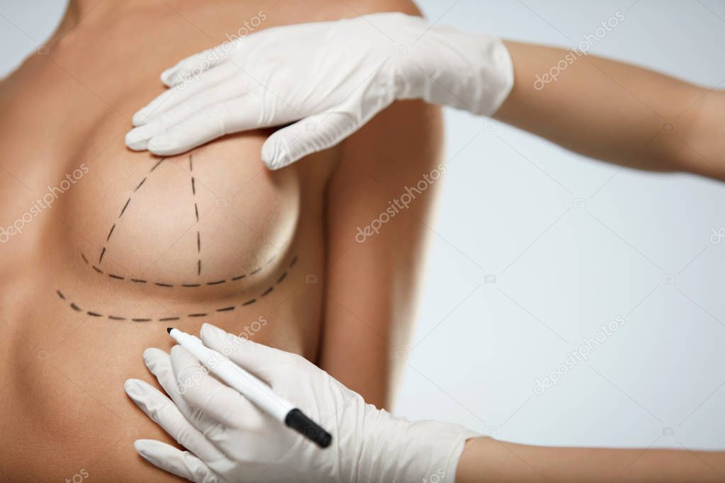 Hands Drawing Lines On Beautiful Woman Breast. Plastic Surgery