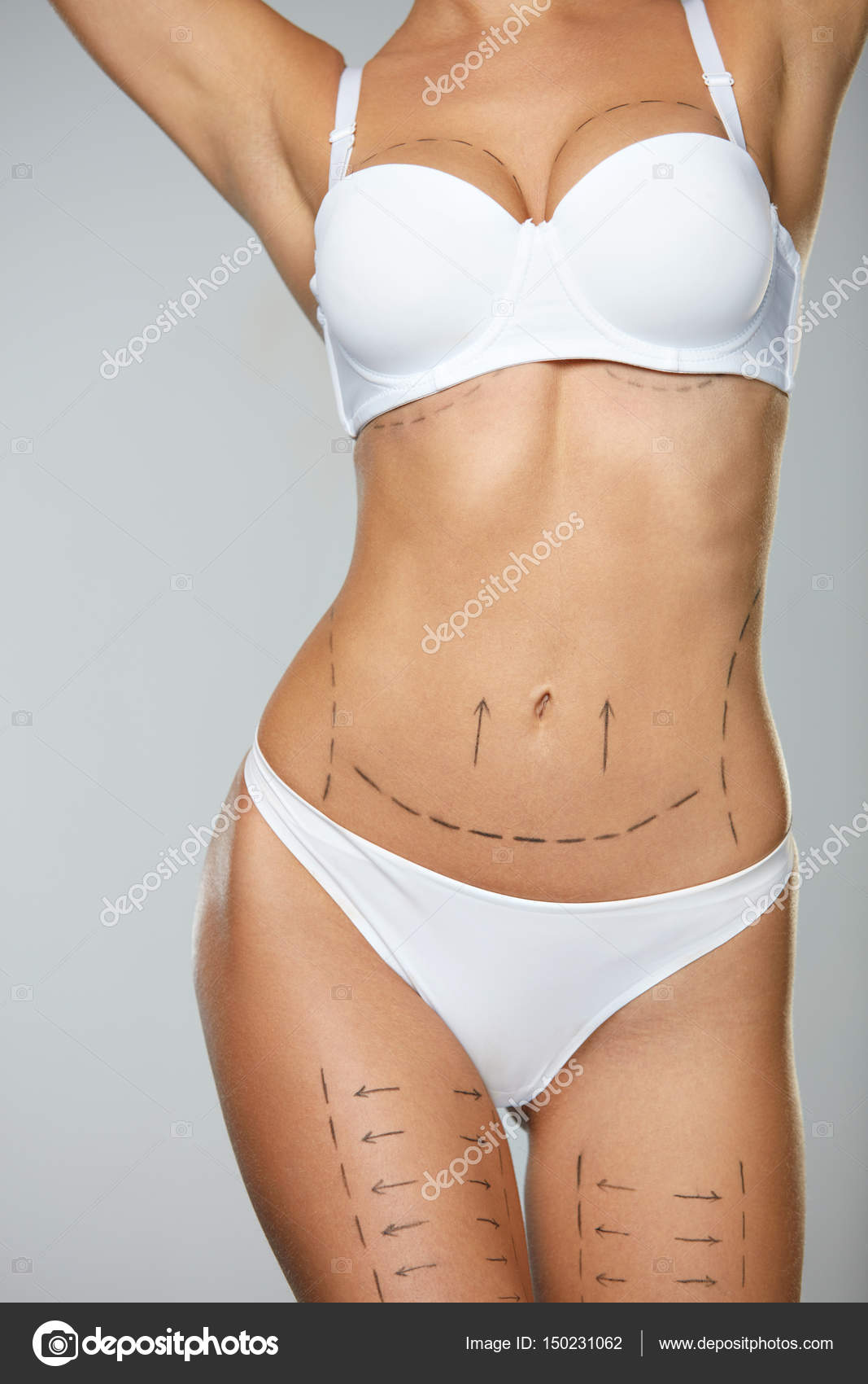 Hermoso cuerpo de mujer con l neas quir rgicas. Operaci n