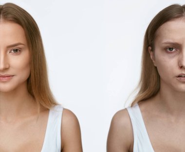 Şiddet. Kadın yüz yaralar ile