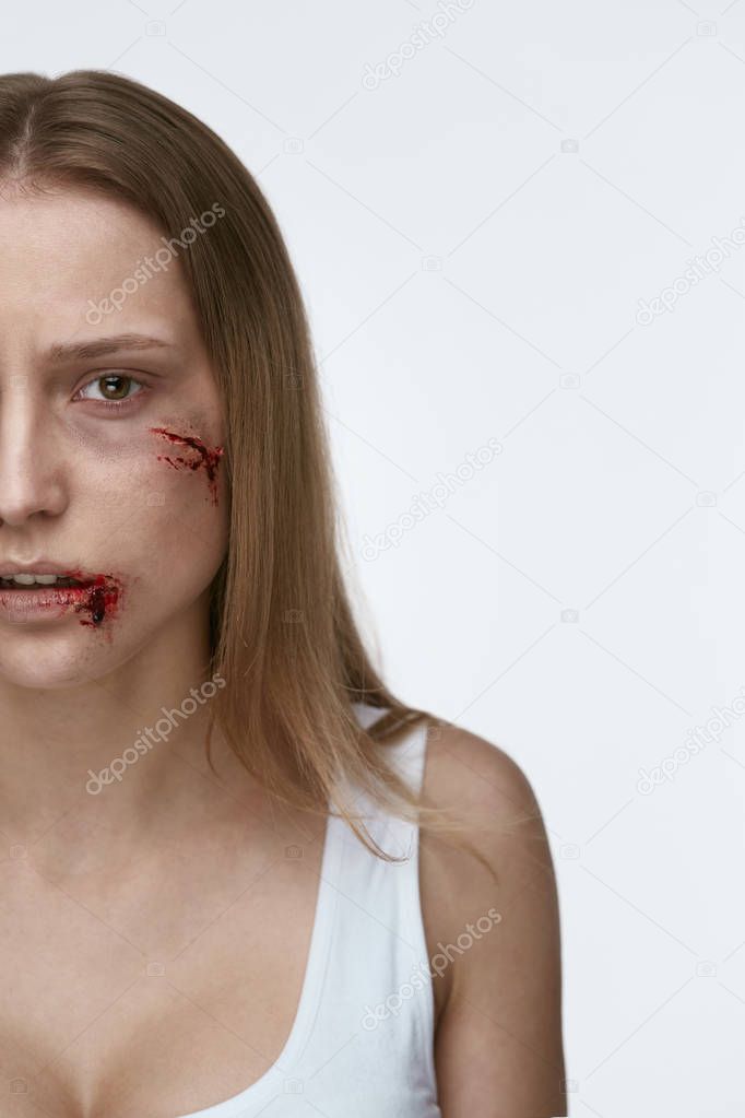 Violence Against Women. Woman With Bloody Wound On Face
