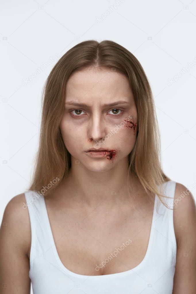 Domestic Violence. Woman With Beating On Face