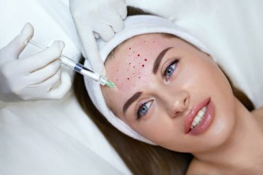 Yüz bakımı. Alnına Yaşlanma Karşıtı Güzellik İğnesi. Kozmetik Kliniği 'nde cilt Gençleştirme Prosedürü. Şırıngayla Eldivenli Güzellik Uzmanı.
