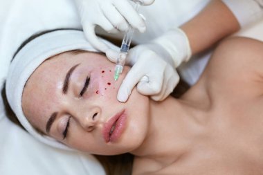 Yüz Güzelliği Tedavisi. Yaşlanma önleyici kolajen enjeksiyonu. Kozmetik Kliniği 'nde cilt bakımı. Şırıngayla Eldivenli Güzellik Uzmanı.