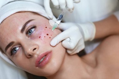 Yüz Güzelliği Tedavisi. Yaşlanma önleyici kolajen enjeksiyonu. Kozmetik Kliniği 'nde cilt bakımı. Şırıngayla Eldivenli Güzellik Uzmanı.