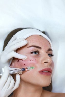 Yüz bakımı. Kozmetik Kliniğine Hyaluronik Asit Cilt Enjeksiyonu. Güzellik Uzmanı Yaşlanma Karşıtı Güzellik Prosedürü Yapıyor.
