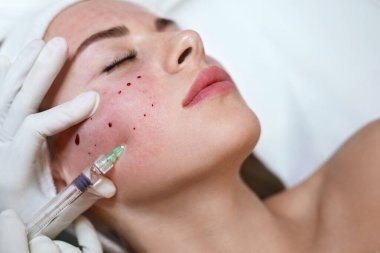 Yüz bakımı. Kozmetik Kliniğine Hyaluronik Asit Cilt Enjeksiyonu. Güzellik Uzmanı Yaşlanma Karşıtı Güzellik Prosedürü Yapıyor.