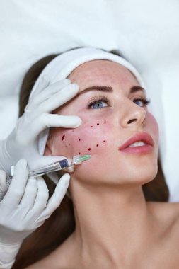 Yüz bakımı. Kozmetik Kliniğine Hyaluronik Asit Cilt Enjeksiyonu. Güzellik Uzmanı Yaşlanma Karşıtı Güzellik Prosedürü Yapıyor.
