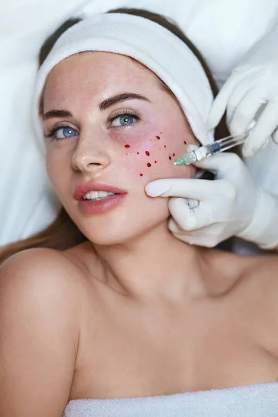 面部护理治疗 女性化妆品诊所的抗衰老注射美容术 美容师手拿着注射器 — 图库照片