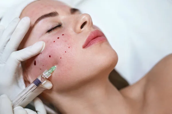 Leczenie Twarzy Wstrzyknięcie Kwasu Hialuronowego Pielęgnacji Skóry Klinice Kosmetycznej Kosmetyk — Zdjęcie stockowe