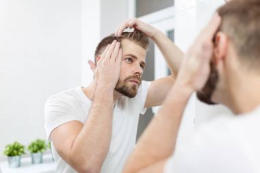 Yakışıklı genç hairloss hakkında endişeli