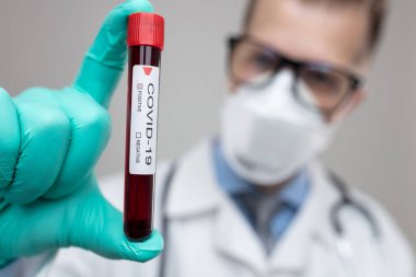 Coronavirus Covid-19 kan testi örneğini tutan solunum maskesi takan bir sağlık görevlisi., 