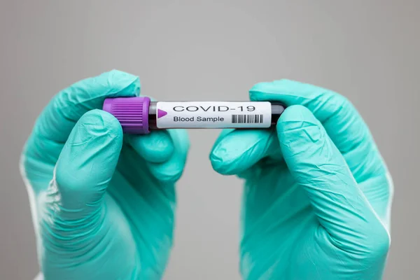 Légzőmaszkot Viselő Egészségügyi Dolgozó Kezében Coronavirus Covid Vérvizsgálati Mintával — Stock Fotó