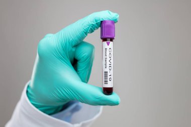Doktor solunum maskesi takıyor ve Coronavirus Covid-19 kan örneğini tutuyor. 
