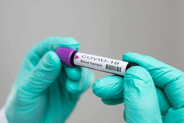 Orvos Légzőmaszkot Visel Coronavirus Covid Vérmintát Tartja — Stock Fotó