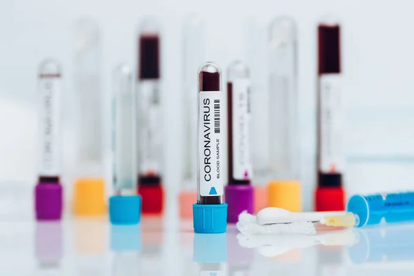 Coronavirus Laboratóriumi Mintájának Vizsgálata Stock Kép