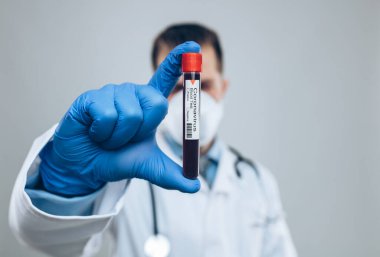 Doktor solunum maskesi takıyor ve Coronavirus Covid-19 kan örneğini tutuyor. 