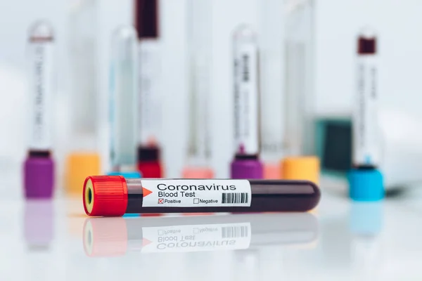 Testar Amostra Laboratório Novo Coronavirus — Fotografia de Stock