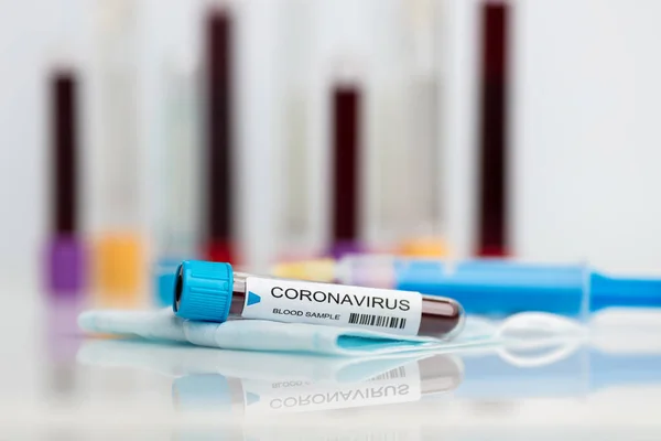 Testarea Probei Laborator Noului Coronavirus — Fotografie, imagine de stoc