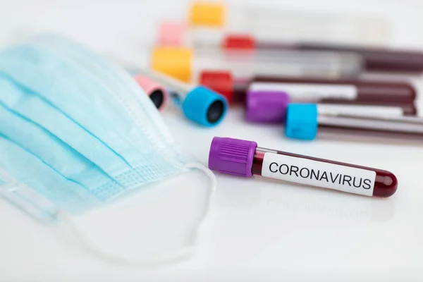 Coronavirus Romanının Laboratuvar Örneğini Test Ediyorum — Stok fotoğraf