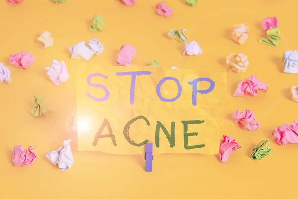 Χειρόγραφο κείμενο που γράφει Stop Acne. Έννοια που σημαίνει έλεγχος της εμφάνισης φλεγμονή σμηγματογόνων αδένων στο δέρμα Χρωματιστά τσαλακωμένα χαρτιά κενό υπενθύμιση λευκό φόντο clothespin. — Φωτογραφία Αρχείου