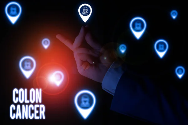 Text sign showing Colon Cancer. Conceptual photo the development of cancer cells from the colon or rectum Male human wear formal work suit presenting presentation using smart device.