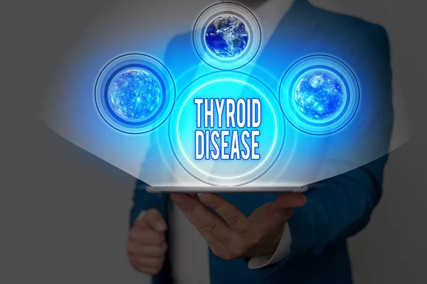 Handwriting text writing Thyroid Disease. Conceptual photo the thyroid gland fails to produce enough hormones Elements of this image furnished by NASA