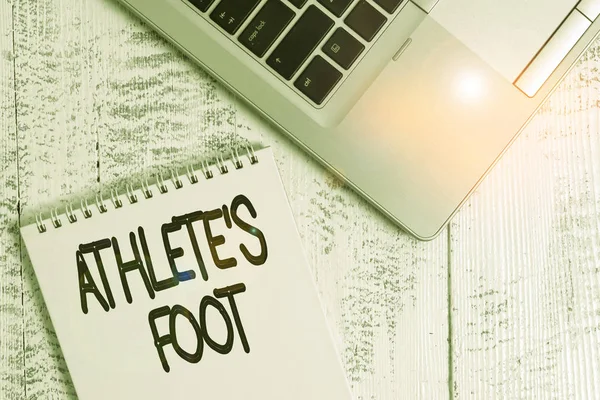 Writing note showing Athlete Foot. Business photo showcasing a fungus infection of the foot marked by blisters Top trendy metallic laptop blank spiral notepad lying on wooden table. — Stok fotoğraf